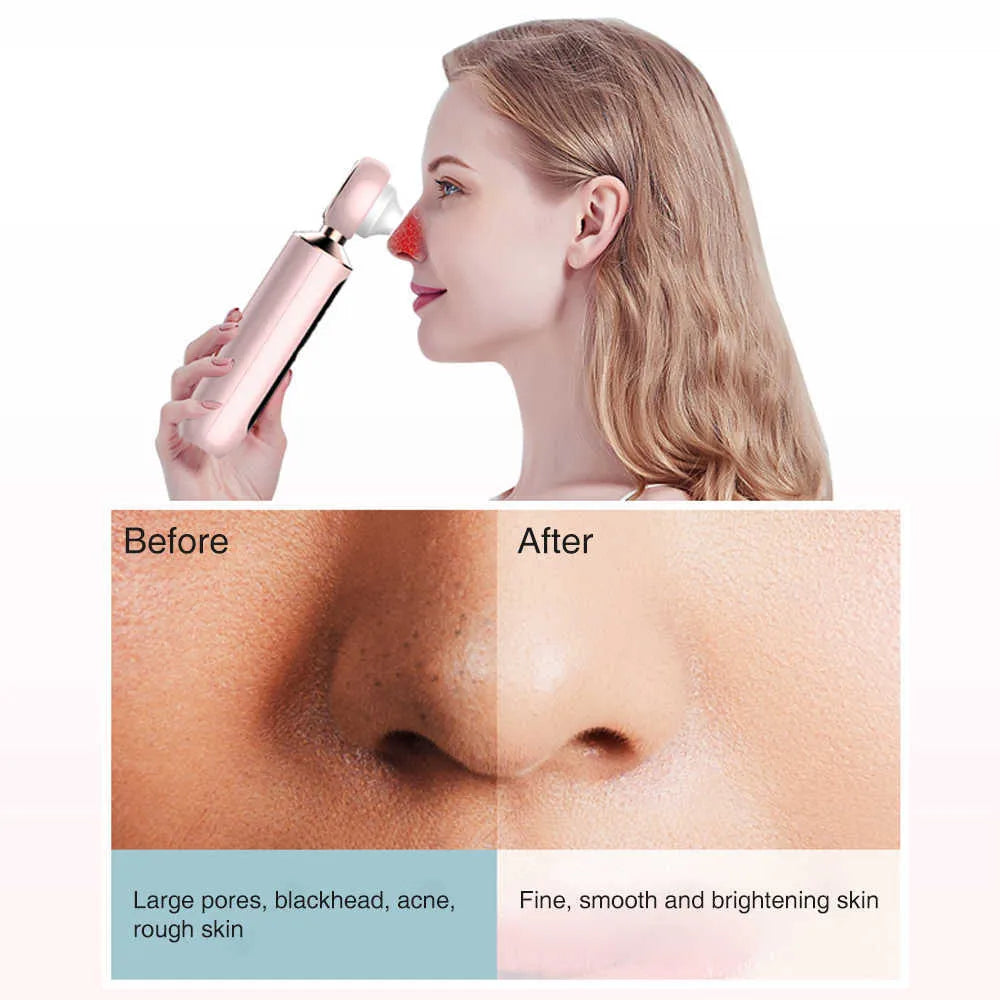 Tijarat™ Blackhead Suction Machine